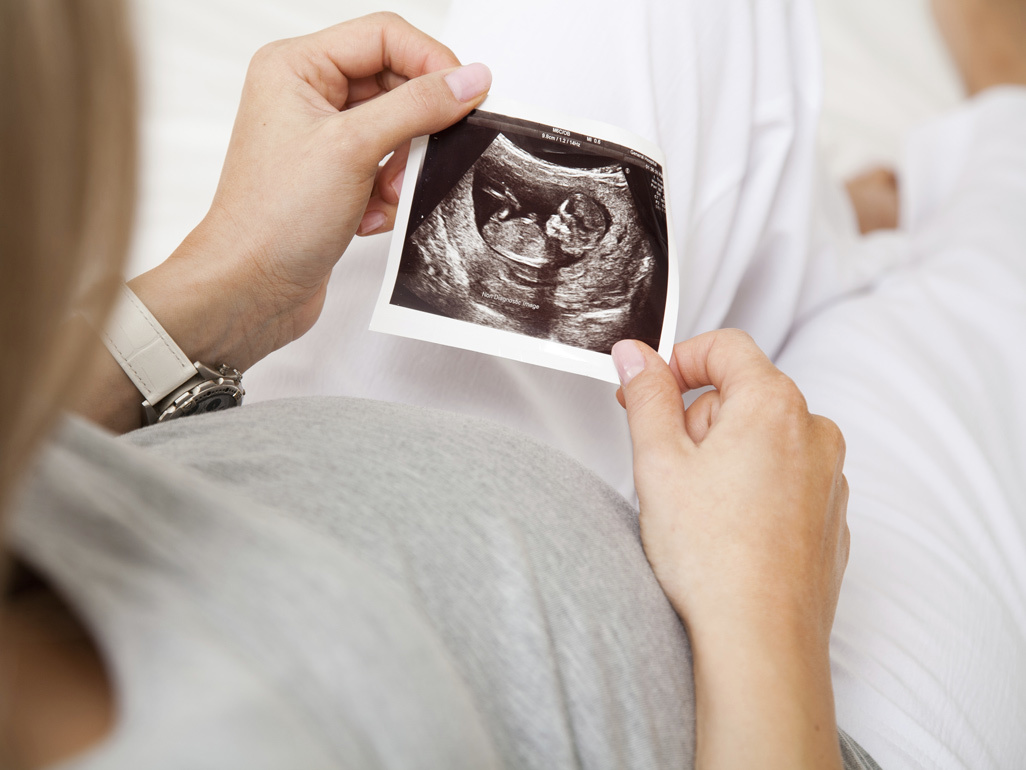 pregnant woman holding ultrasound