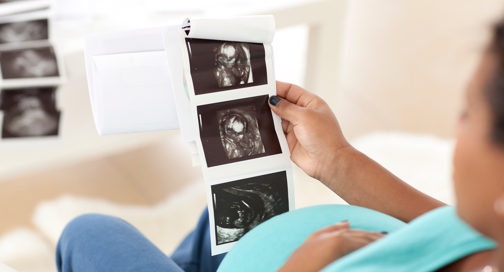 woman looking at ultrasound photos